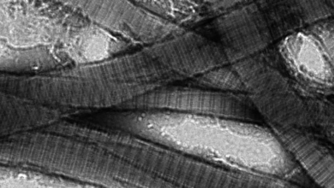 microspopic image of collagen